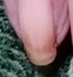 Cuando las uñas piden atención