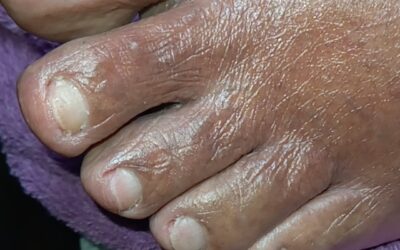 Relación de las enfermedades y uñas sanas