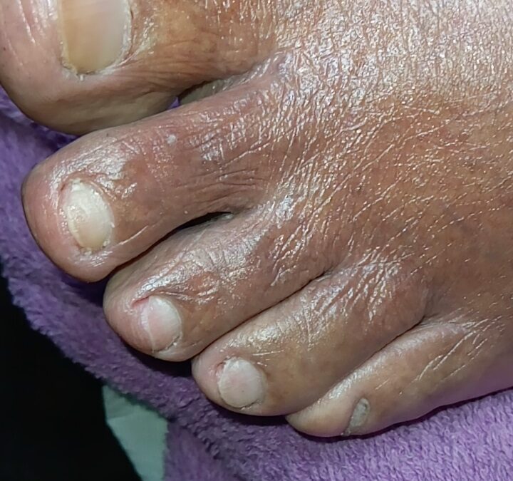 Relación de las enfermedades y uñas sanas