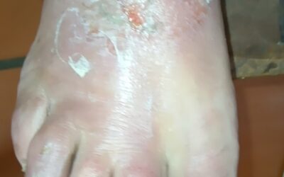 Lesiones de cuidado