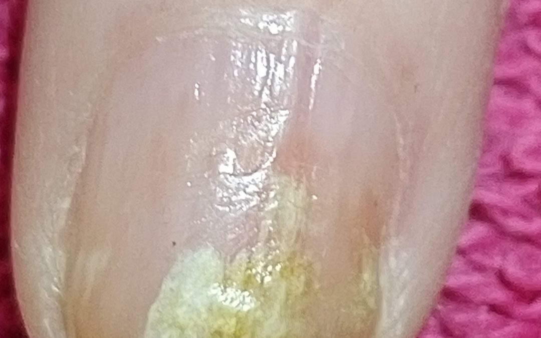 efectos del esmaltado semipermanente en las uñas